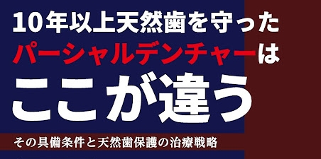 10年以上天然歯を守ったパーシャルデンチャーはここが違う その具備条件と天然歯保護の治療戦略