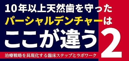 10年以上天然歯を守ったパーシャルデンチャーはここが違う2 治療戦略を具現化する臨床ステップとラボワーク